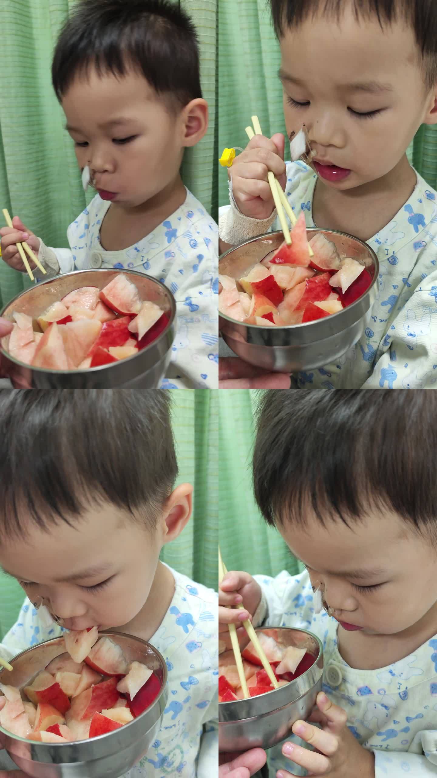竖版生病的小朋友在病房吃水果