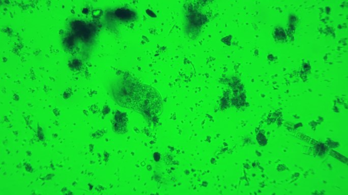 污水中的微生物疫情新冠微小病原螨虫