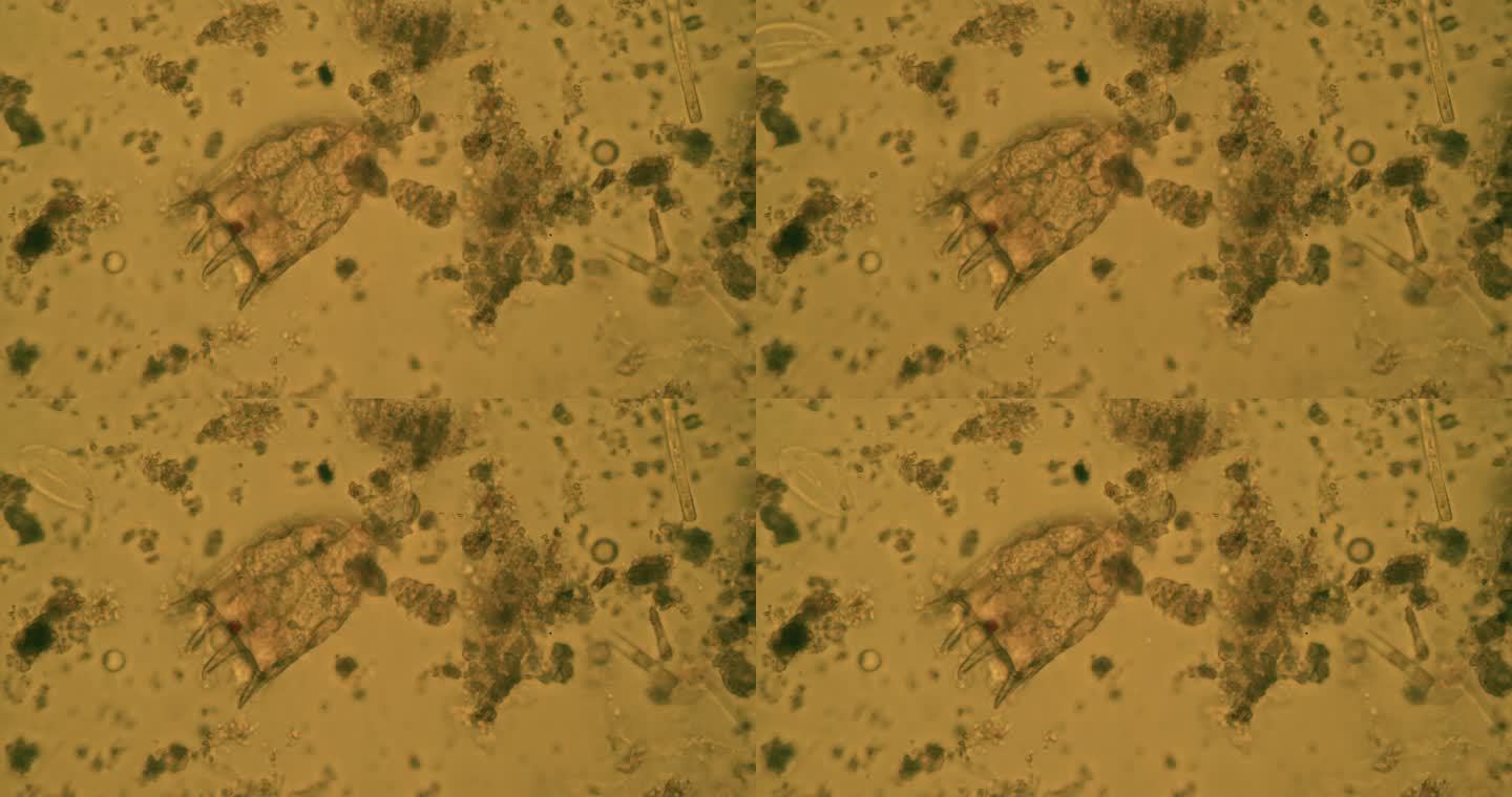 污水中的微生物显微镜病毒观察