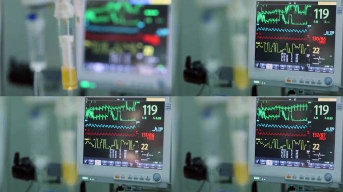 现代医院ICU的心电图监测仪、滴管、医疗设备。库存视频土耳其，医院，急诊室，重症监护室，脉搏追踪