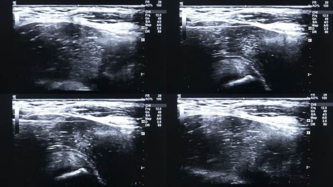 超声波体检产检身体健康屏幕显示图像仪器视