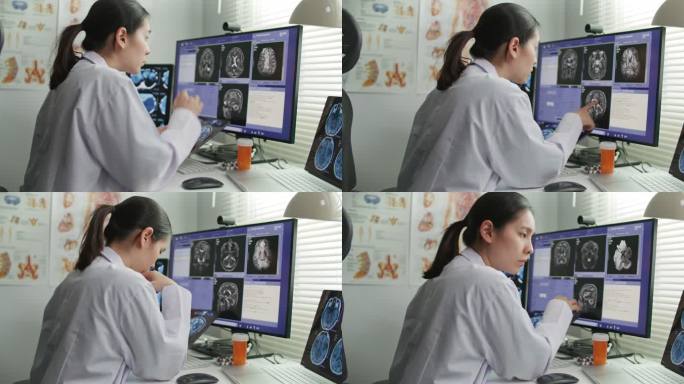 女性放射学家分析头部扫描