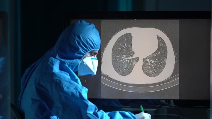 放射科医生在放射诊所检查患者胸部CT图像的4K视频