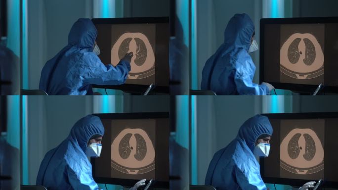 放射科医生在放射诊所检查患者胸部CT图像的HD视频