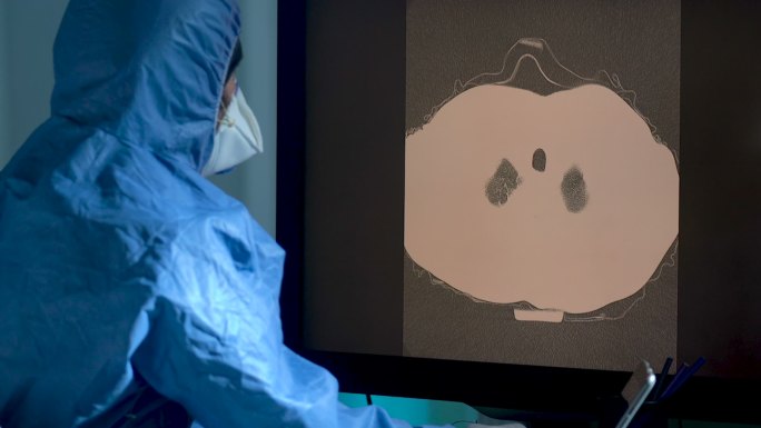 放射科医生在放射诊所检查患者胸部CT图像的HD视频