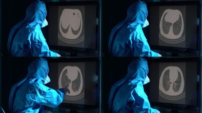 放射科医生在放射诊所检查患者胸部CT图像的4K视频