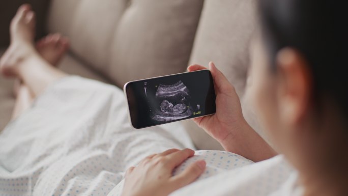 孕妇坐在沙发上，看着手机上的超声波图像