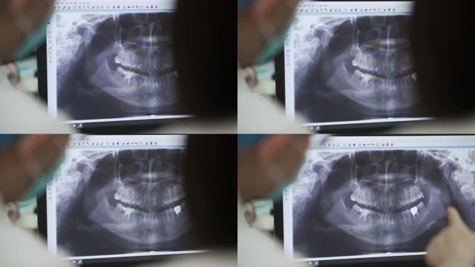 看x光片的牙医x光片牙医