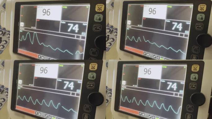 手术室视频系列中医院设备生命功能（生命体征）监测器的传输问题