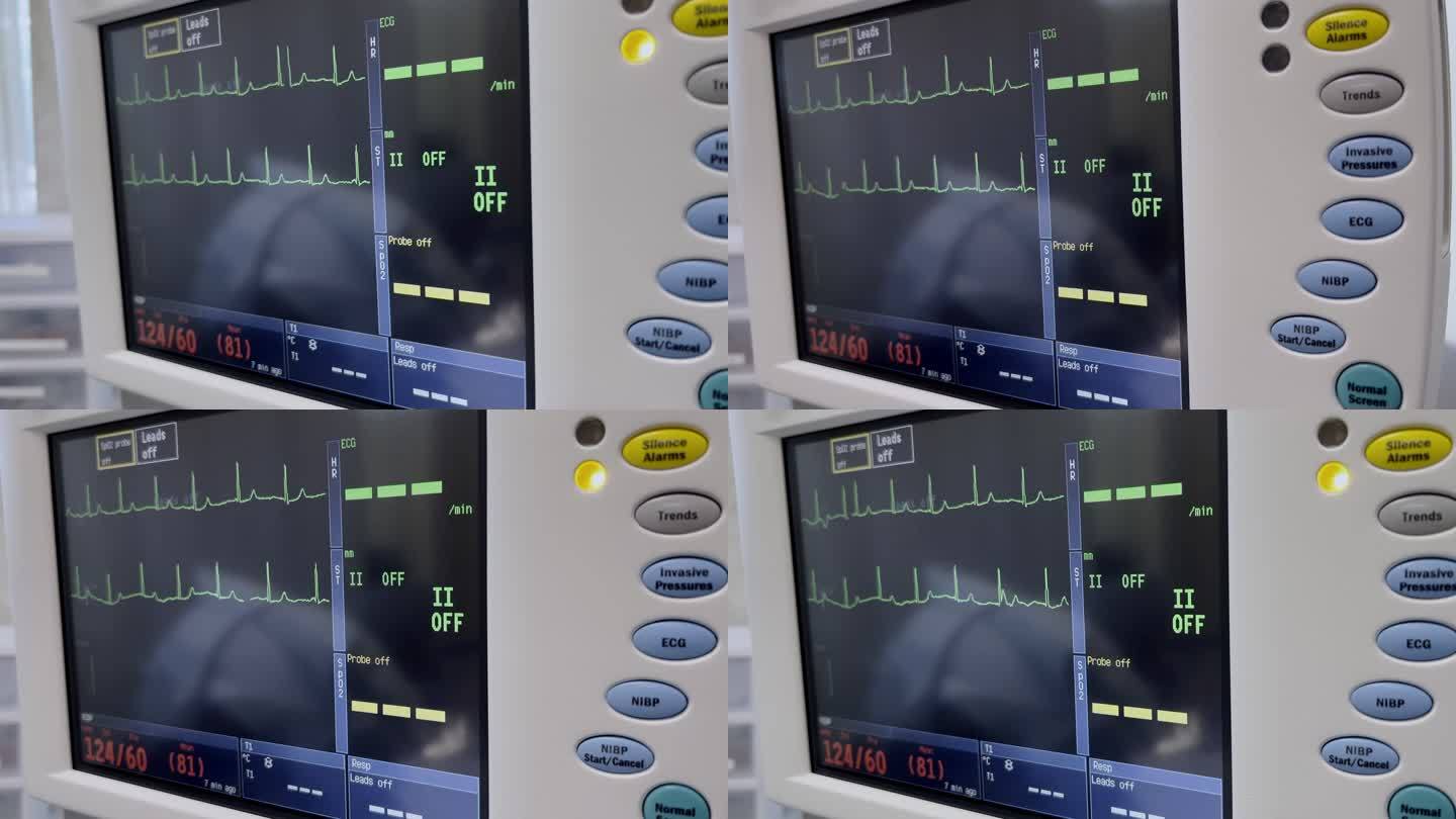 手术室视频系列中的门诊手术医院设备监测生命功能（生命体征）监测器
