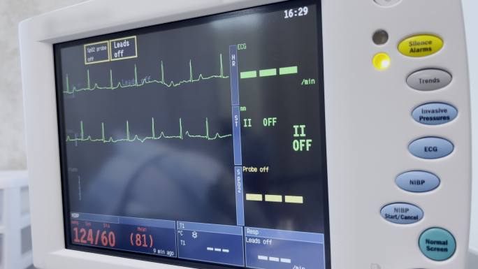手术室视频系列中的医院设备监测生命功能（生命体征）监测器