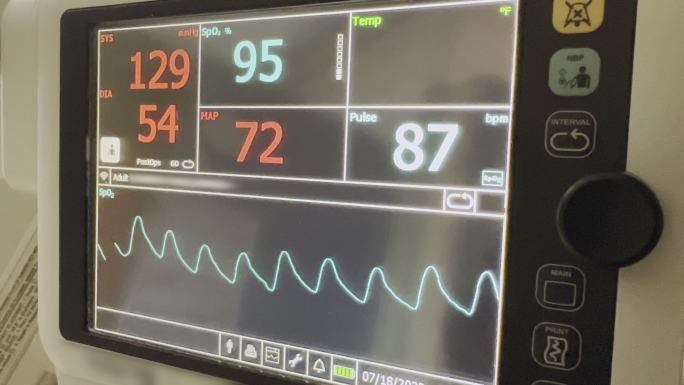 手术室视频系列中的急诊室医院设备监测生命功能（生命体征）监测器