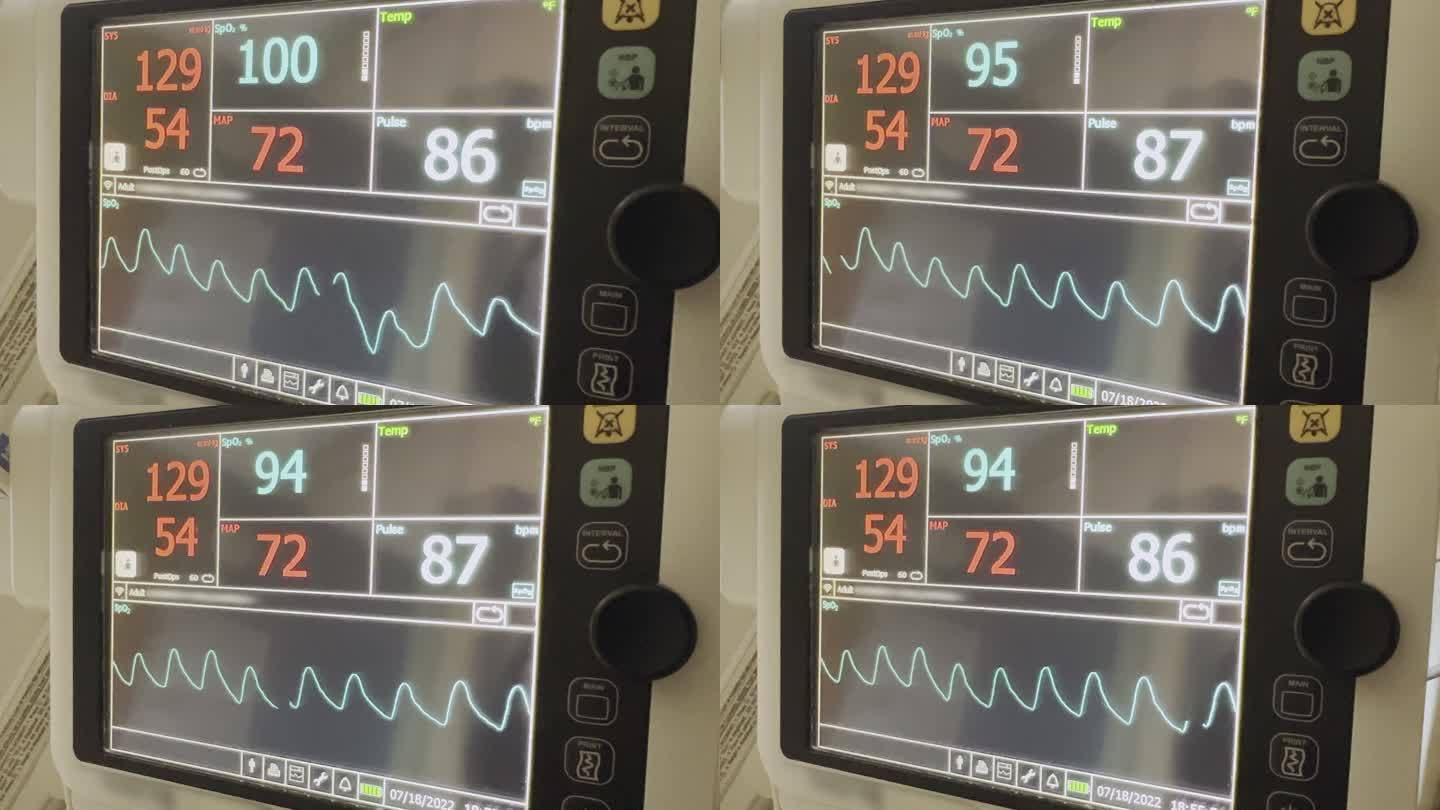 手术室视频系列中的急诊室医院设备监测生命功能（生命体征）监测器