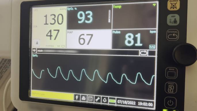 手术室视频系列中医院设备监测生命功能（生命体征）监测器的错误