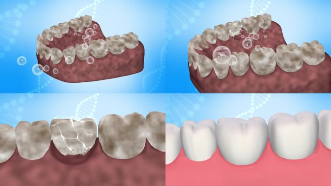 AE模板 4K牙龈护理广告