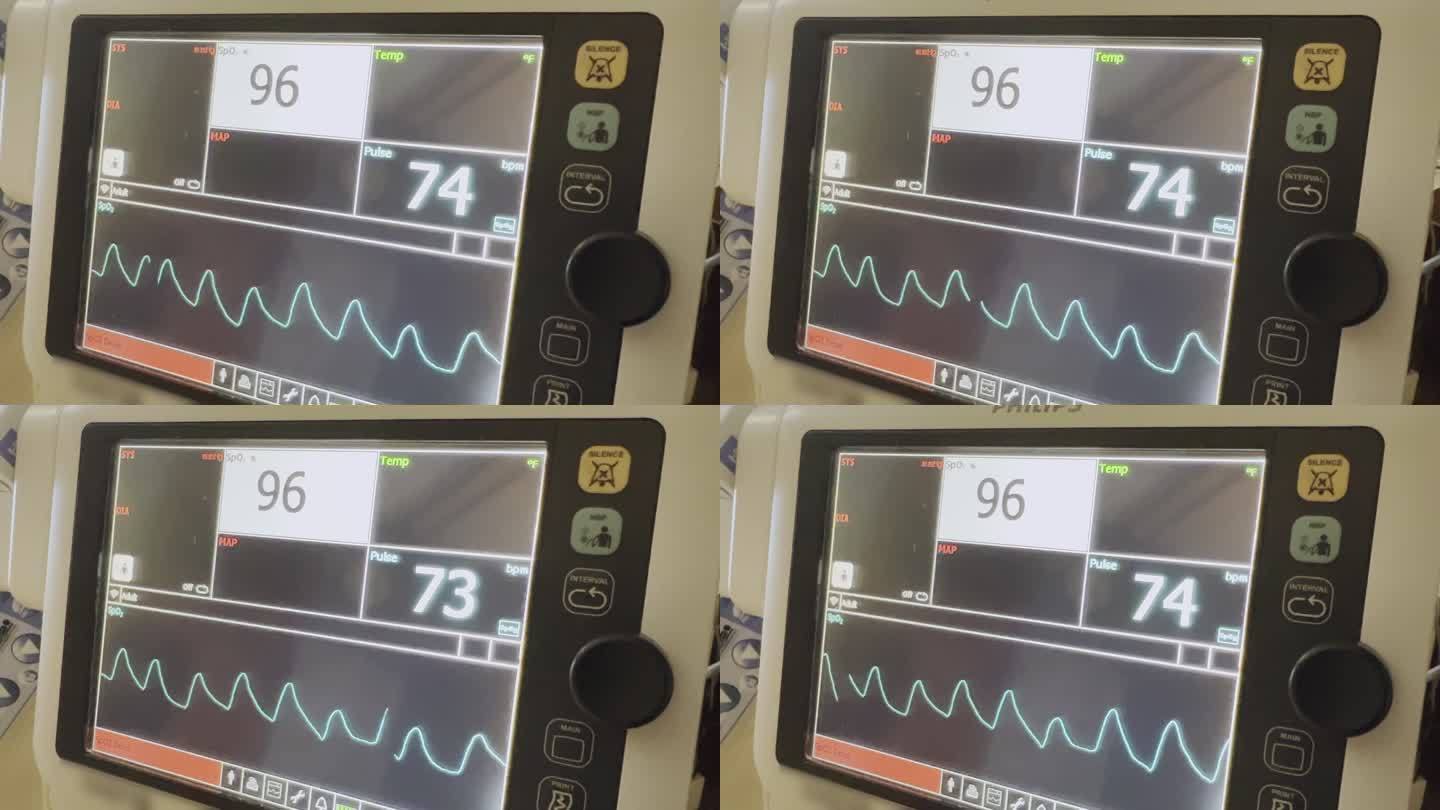 手术室视频系列中医院设备监测生命功能（生命体征）监测器的传输故障