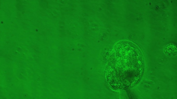 污水中的微生物高倍植物细胞生物细胞