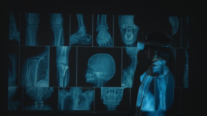 现代科技体检拍片X光片病情报告