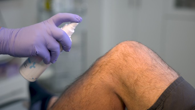 女护士使用抗菌剂消毒患者膝盖的B-卷