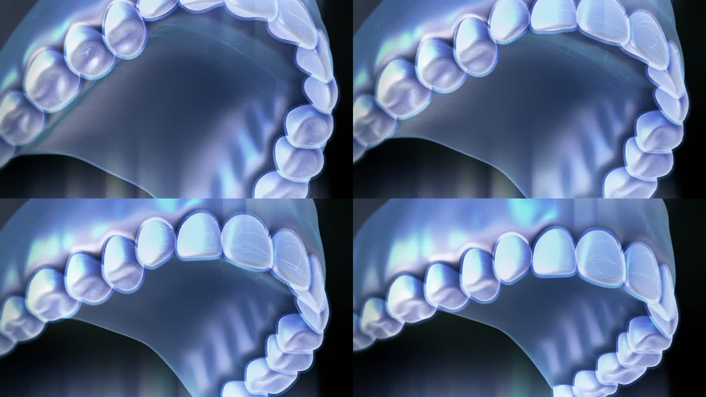 隐形正畸牙科模型三维3D牙齿矫正带牙套
