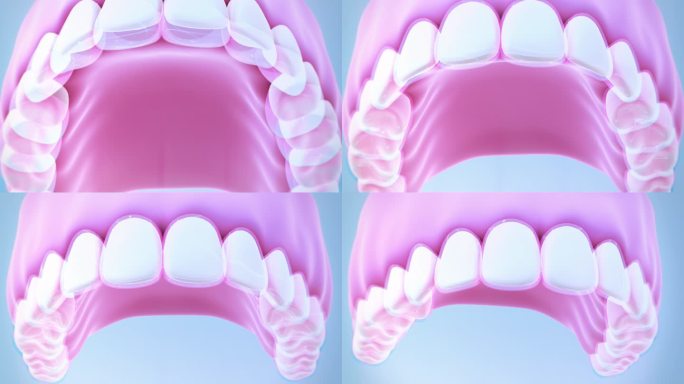 隐形正畸牙科模型三维3D牙齿矫正带牙套