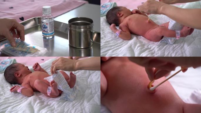 婴儿脐带护理