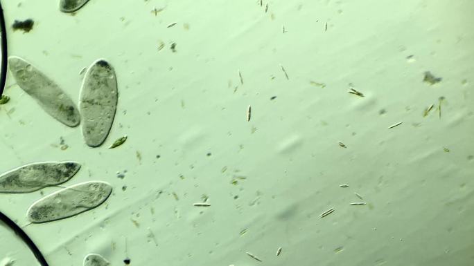 显微镜下的很多草履虫 放大100倍