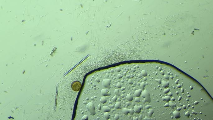 显微镜下的大量细菌与硅藻 放大100倍