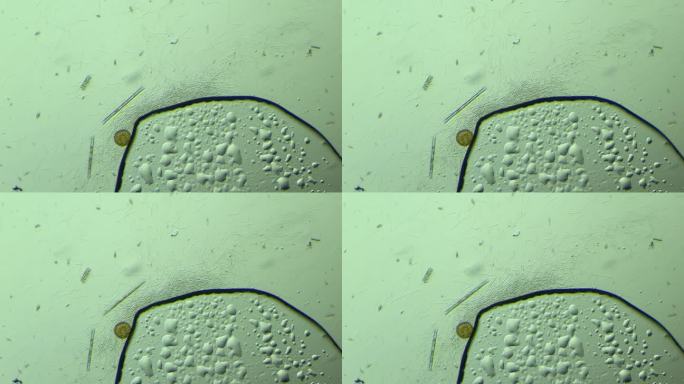 显微镜下的大量细菌与硅藻 放大100倍