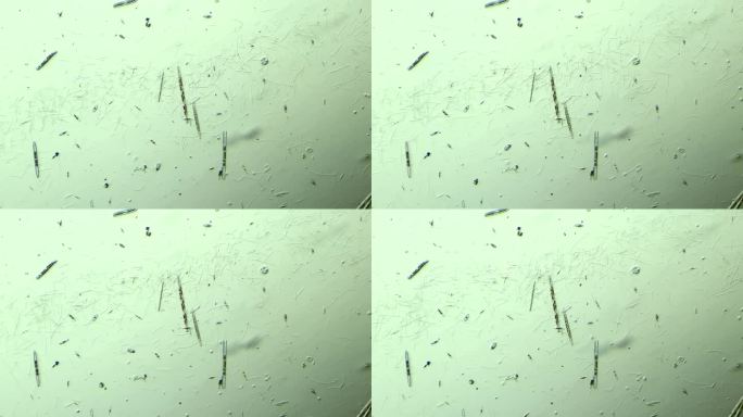 显微镜下的细菌与硅藻 放大100倍 1