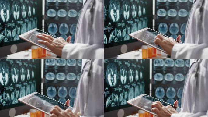 医生使用数字平板电脑分析CT/MRI脑扫描图像
