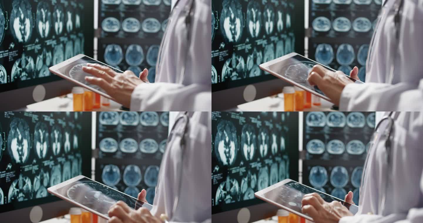 医生使用数字平板电脑分析CT/MRI脑扫描图像