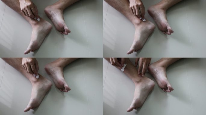 亚洲男人觉得腿上有疤痕，在医疗和保健方面搔痒