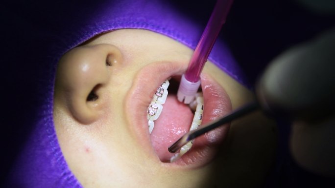牙医正在给病人的牙齿做检查