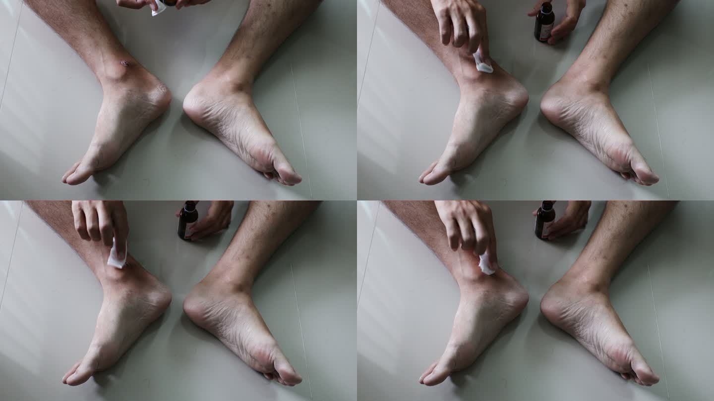 亚洲男人觉得腿上有疤痕，在医疗和保健方面搔痒