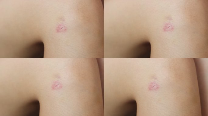 亚洲女性感到腿部发痒和抓痒，医疗和保健上有疤痕