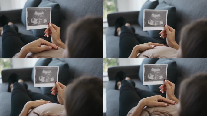女性外观3D超声扫描