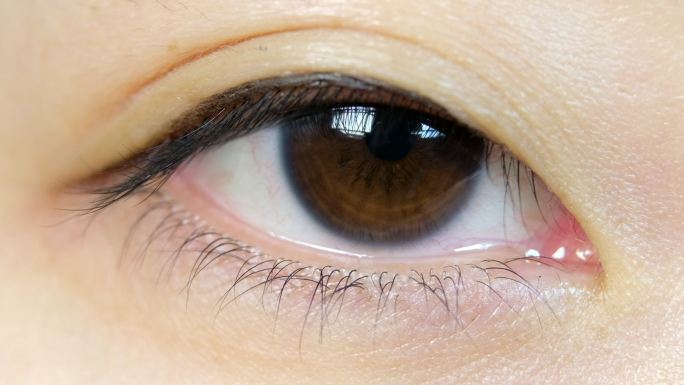 日本女性眼球宏眼神眼睛疾病眨睛闭眼