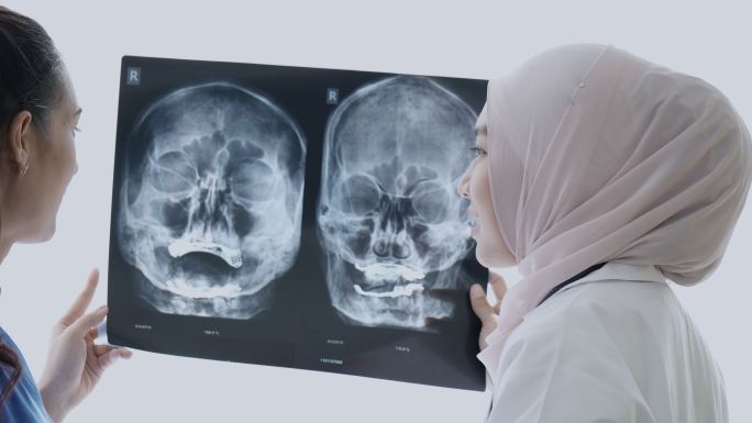 穆斯林医生显示扫描结果。