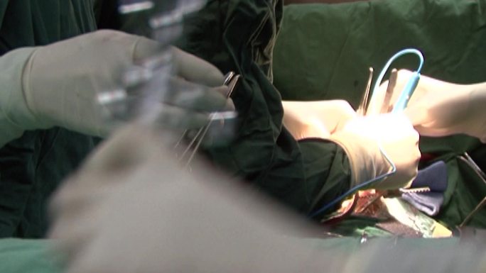 手术递器械  手术  外科手术  缝合