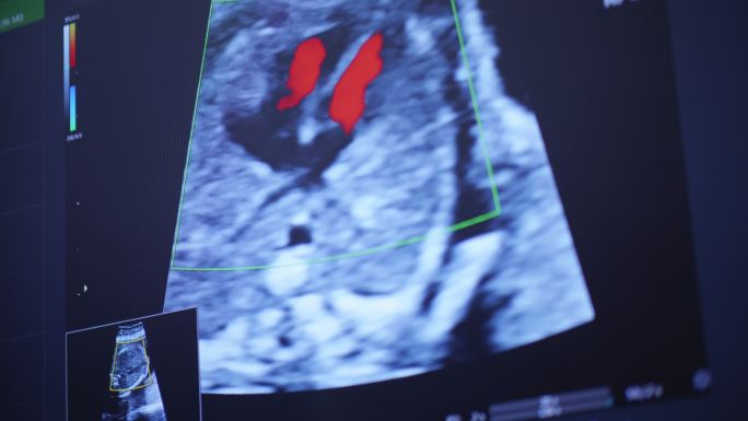 超声扫描妊娠3d和4d超声妊娠胎儿检查人类胚胎胎儿超声检查26周孕中期母体女婴体检