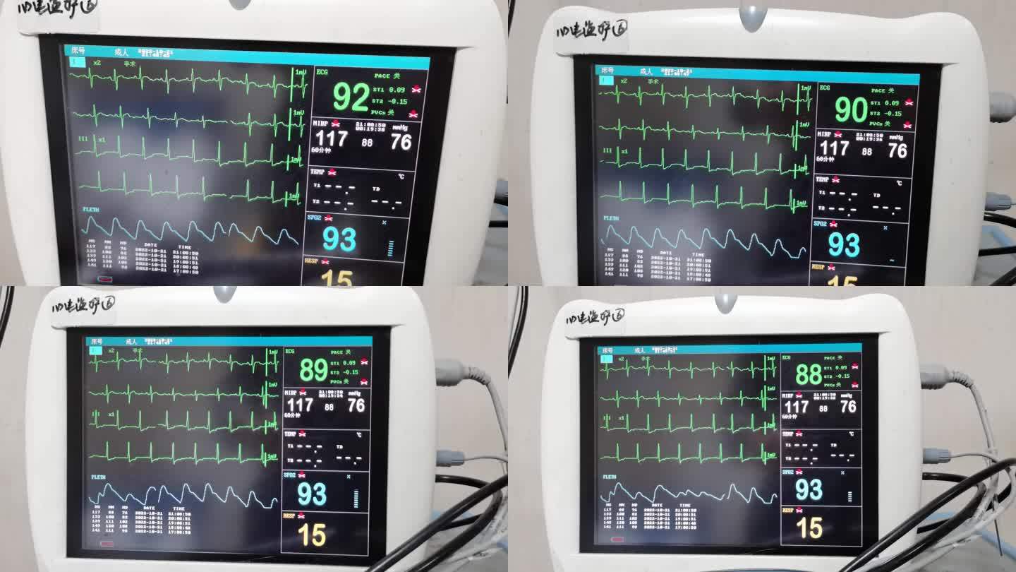 心电监护仪2