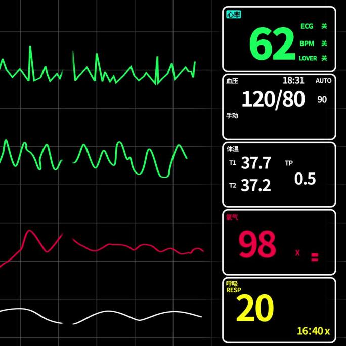 医疗数据心电图呼吸机AE模板