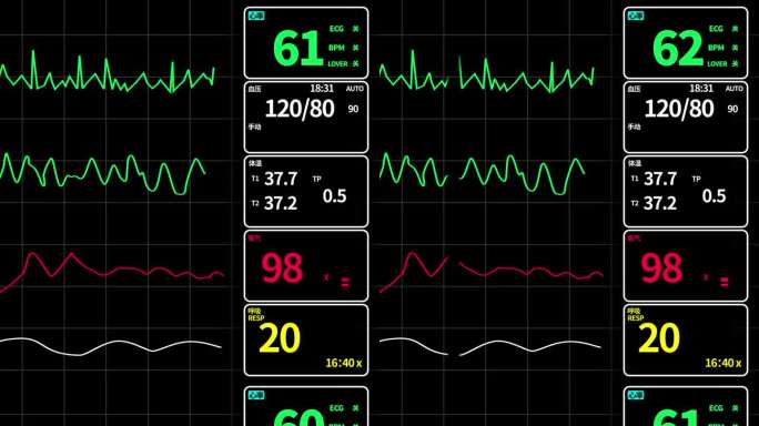医疗数据心电图呼吸机AE模板