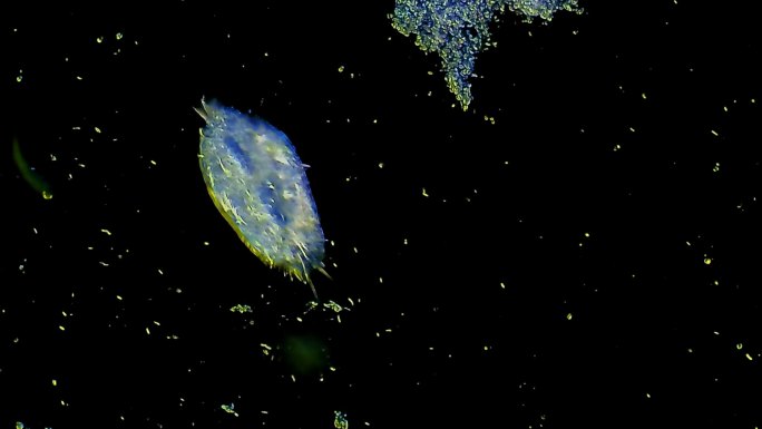微生物-纤毛虫病毒进食微观世界