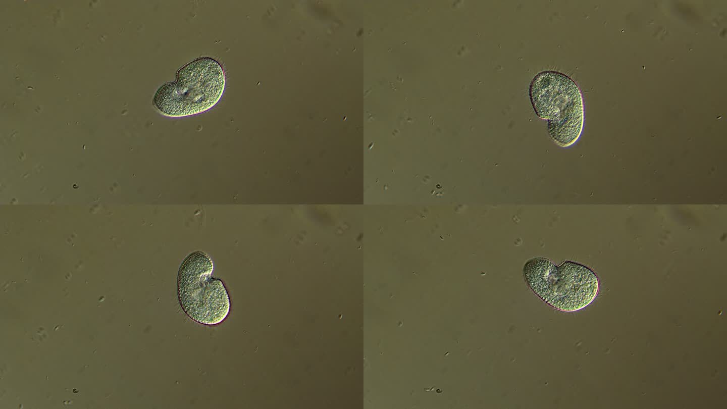 纤毛虫微生物显微镜