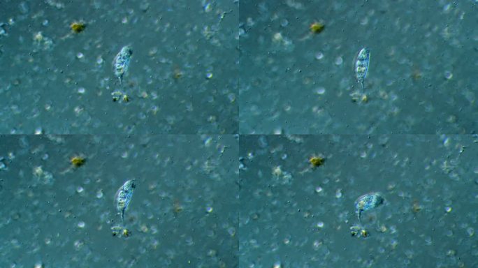 轮虫-微生物轮虫微生物显微镜观察