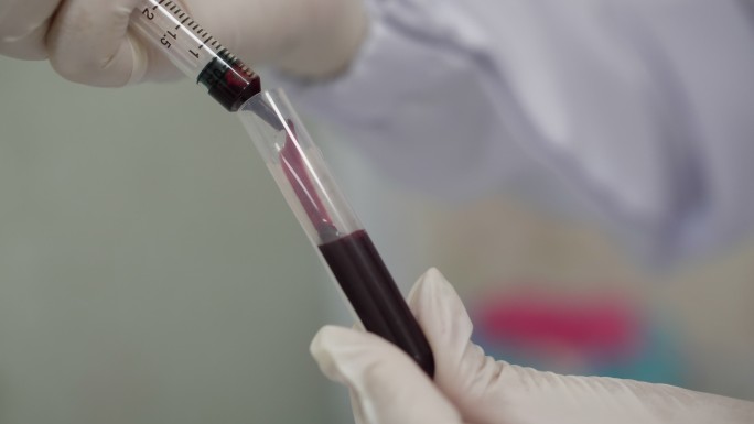 科学家在实验室用血样注入血液