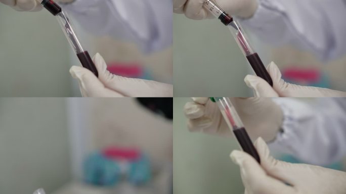 科学家在实验室用血样注入血液