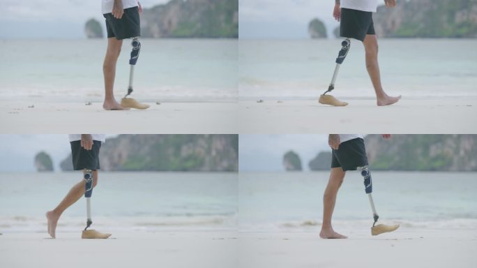 特写：一名戴假肢的残疾人早上在海滩上散步。残障收藏：日常生活理念。